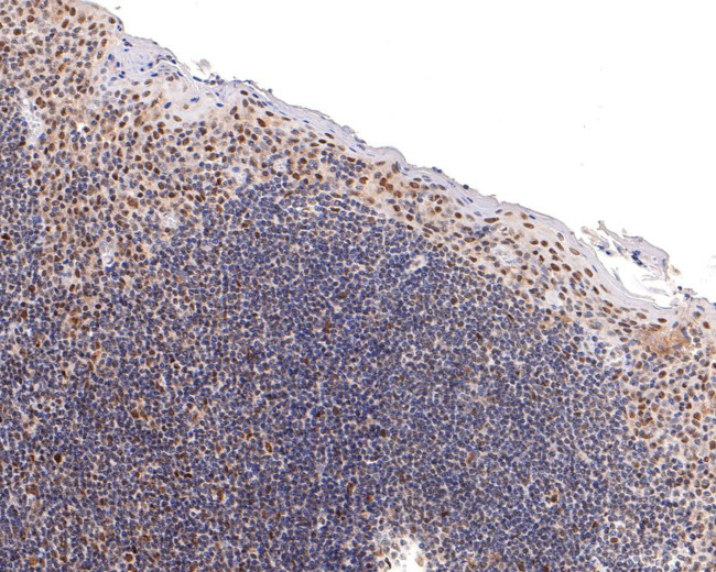 HDAC2 Antibody in Immunohistochemistry (Paraffin) (IHC (P))