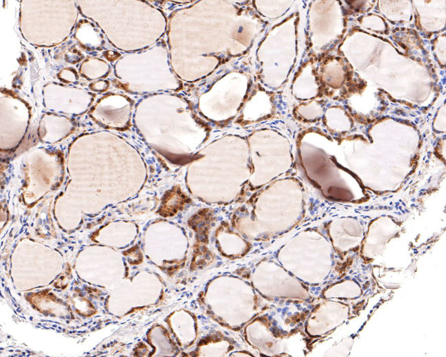 HDAC2 Antibody in Immunohistochemistry (Paraffin) (IHC (P))