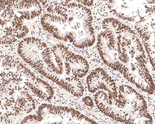 HDAC2 Antibody in Immunohistochemistry (Paraffin) (IHC (P))