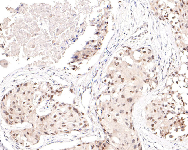 HDAC2 Antibody in Immunohistochemistry (Paraffin) (IHC (P))