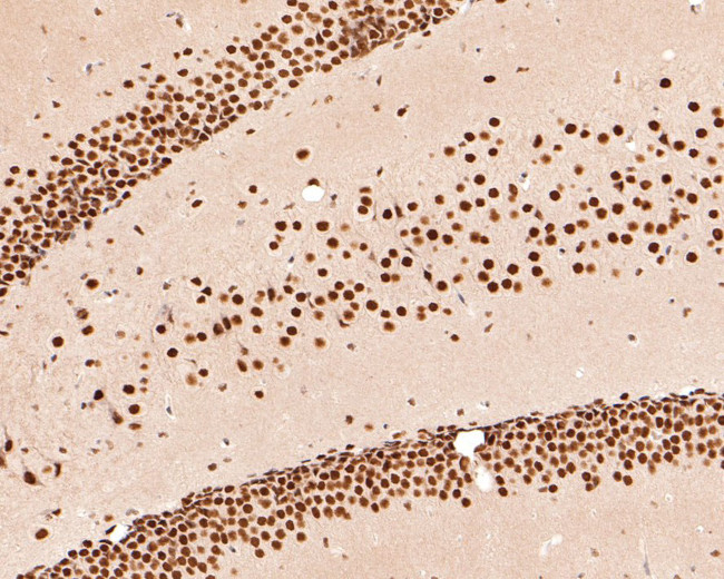 HDAC2 Antibody in Immunohistochemistry (Paraffin) (IHC (P))