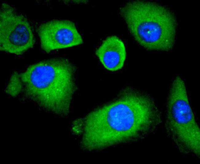 HDAC4 Antibody in Immunocytochemistry (ICC/IF)