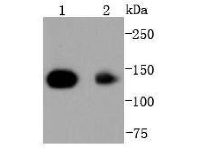 HDAC4 Antibody in Western Blot (WB)