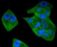 STAT5 beta Antibody in Immunocytochemistry (ICC/IF)