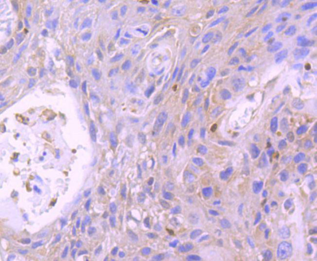 STAT5 beta Antibody in Immunohistochemistry (Paraffin) (IHC (P))