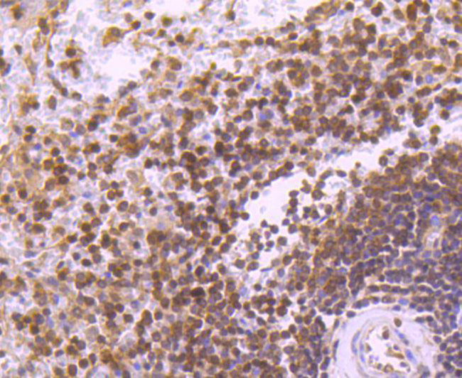 STAT5 beta Antibody in Immunohistochemistry (Paraffin) (IHC (P))