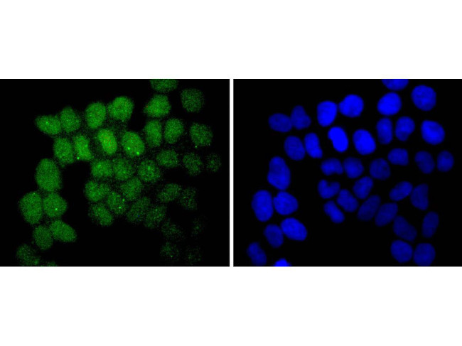 SUZ12 Antibody in Immunocytochemistry (ICC/IF)