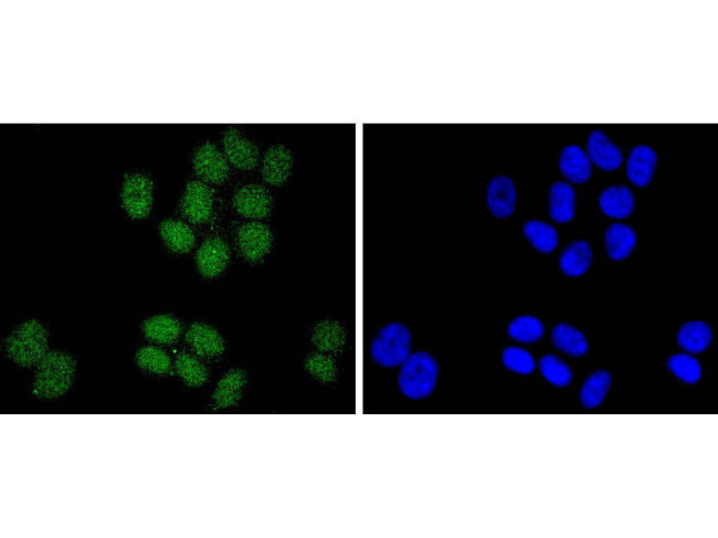 SUZ12 Antibody in Immunocytochemistry (ICC/IF)