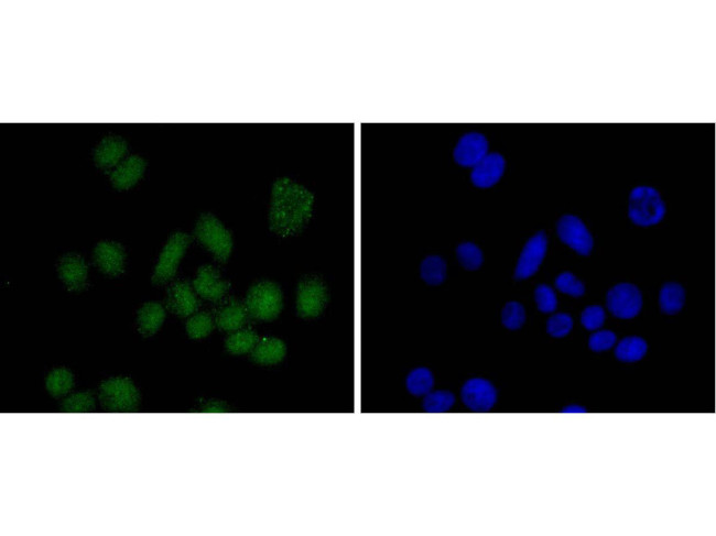 SUZ12 Antibody in Immunocytochemistry (ICC/IF)