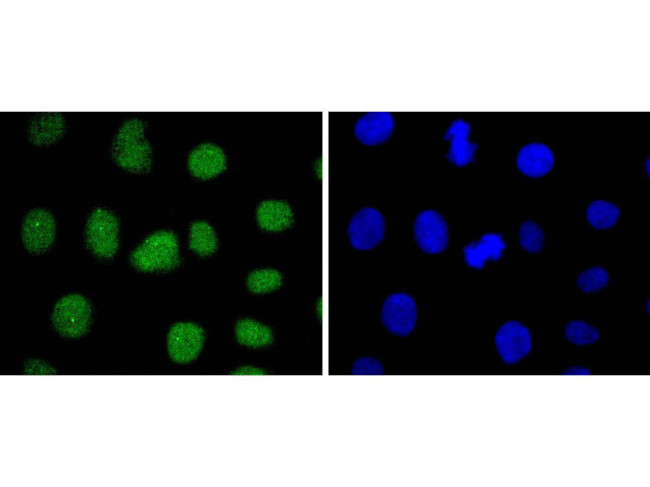 SUZ12 Antibody in Immunocytochemistry (ICC/IF)