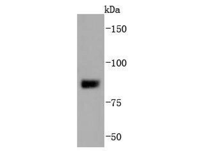 SUZ12 Antibody in Western Blot (WB)