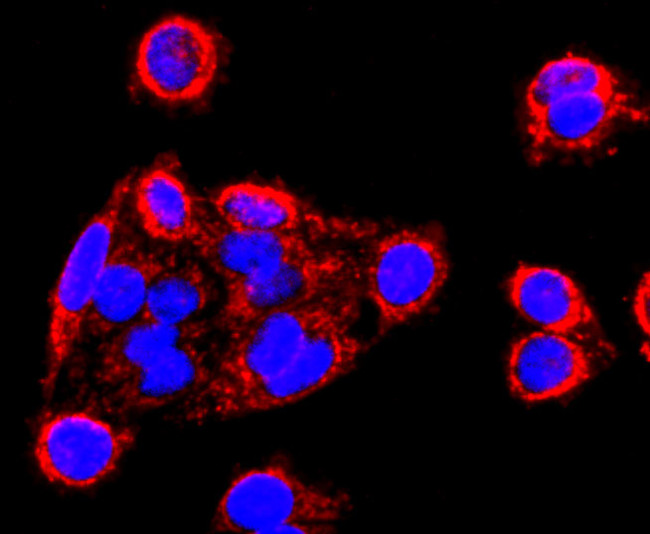 MMP13 Antibody in Immunocytochemistry (ICC/IF)