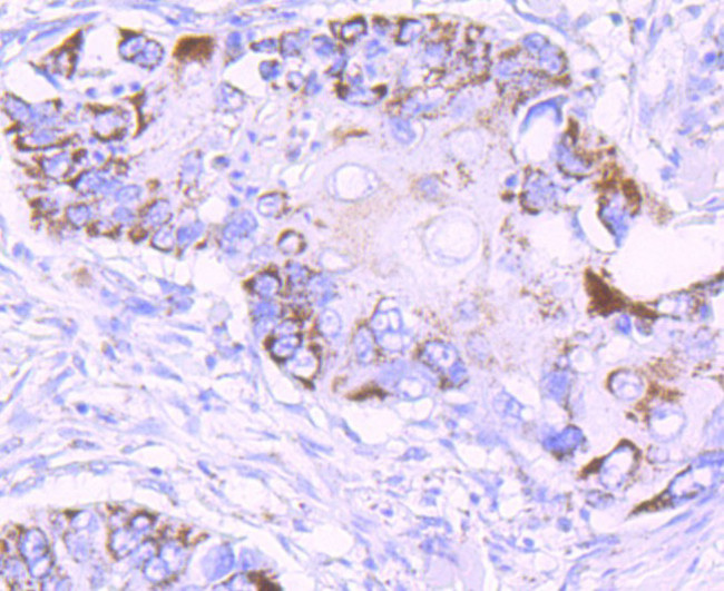 MMP13 Antibody in Immunohistochemistry (Paraffin) (IHC (P))