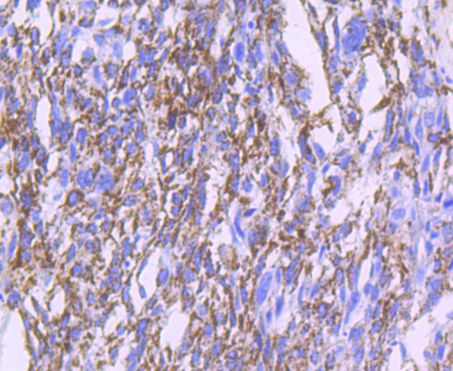 MMP13 Antibody in Immunohistochemistry (Paraffin) (IHC (P))