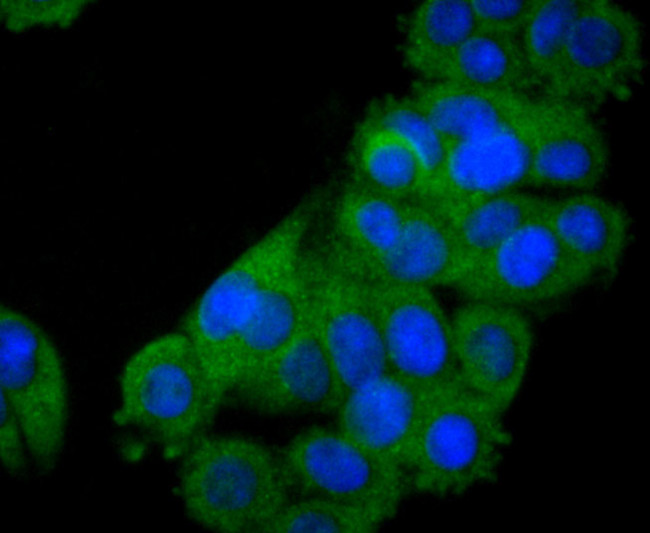 STAT2 Antibody in Immunocytochemistry (ICC/IF)