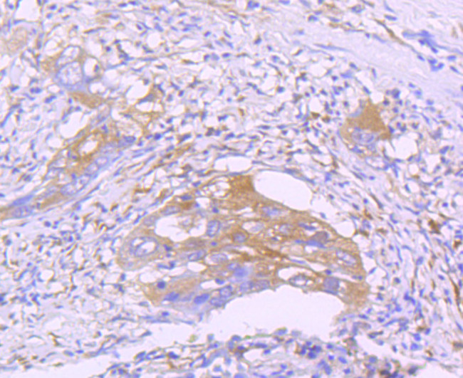 STAT2 Antibody in Immunohistochemistry (Paraffin) (IHC (P))