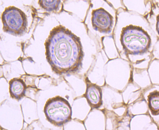 STAT2 Antibody in Immunohistochemistry (Paraffin) (IHC (P))