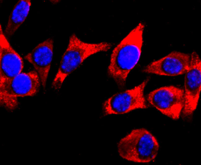 DRD1 Antibody in Immunocytochemistry (ICC/IF)