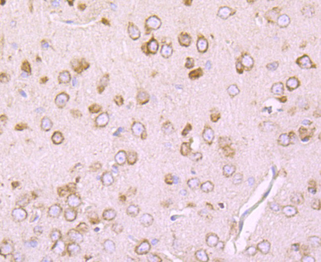 DRD1 Antibody in Immunohistochemistry (Paraffin) (IHC (P))