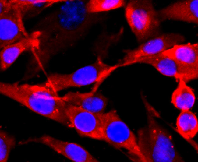 NMDAR1 Antibody in Immunocytochemistry (ICC/IF)