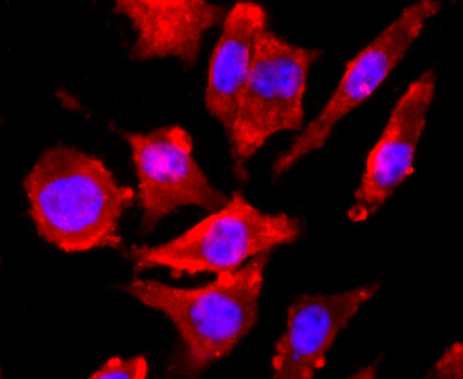 NMDAR1 Antibody in Immunocytochemistry (ICC/IF)