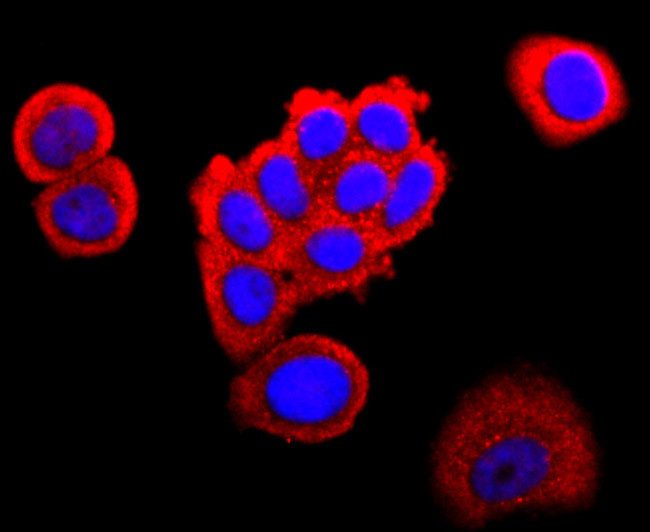 FABP4 Antibody in Immunocytochemistry (ICC/IF)