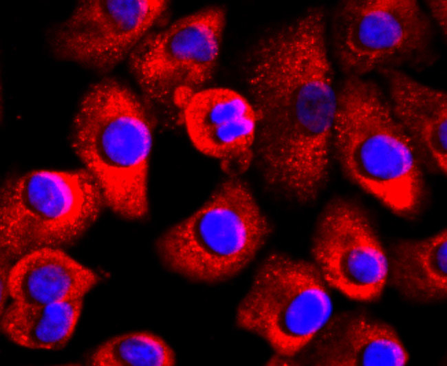 FABP4 Antibody in Immunocytochemistry (ICC/IF)