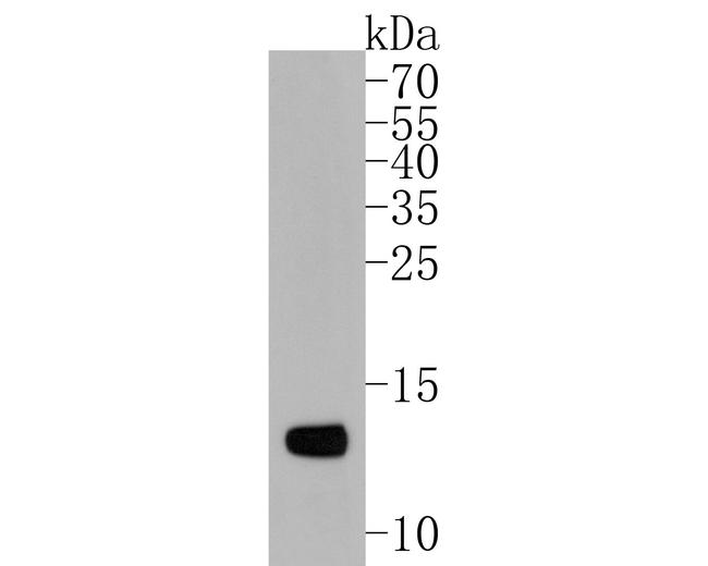 FABP4 Antibody in Western Blot (WB)