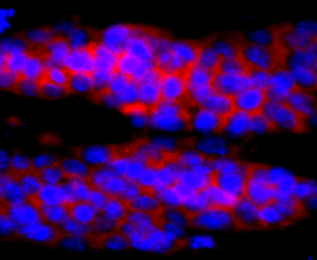 IL-4 Antibody in Immunocytochemistry (ICC/IF)