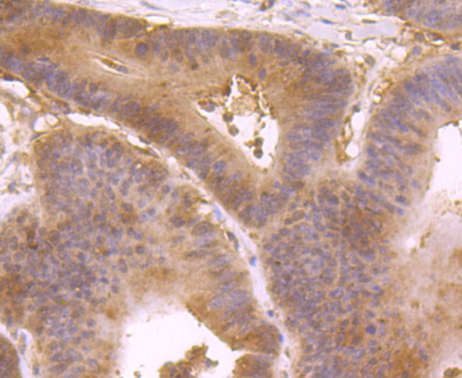 IL-4 Antibody in Immunohistochemistry (Paraffin) (IHC (P))