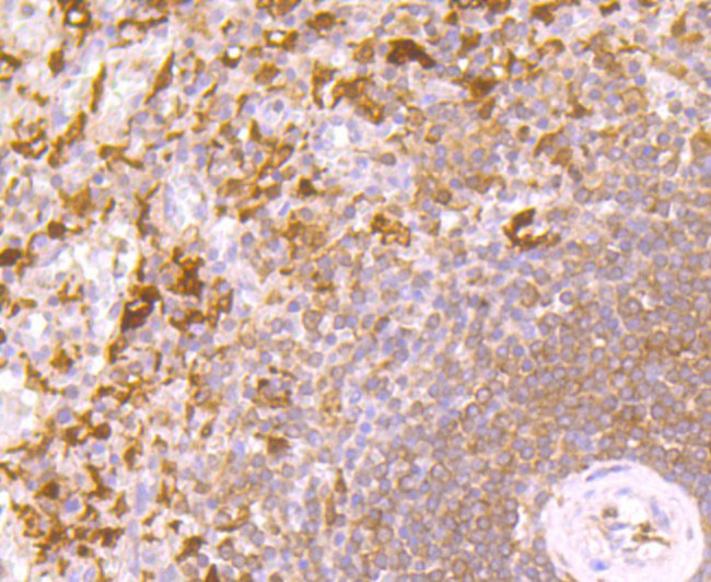 IL-4 Antibody in Immunohistochemistry (Paraffin) (IHC (P))