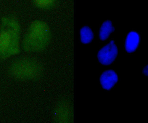 PDCD4 Antibody in Immunocytochemistry (ICC/IF)