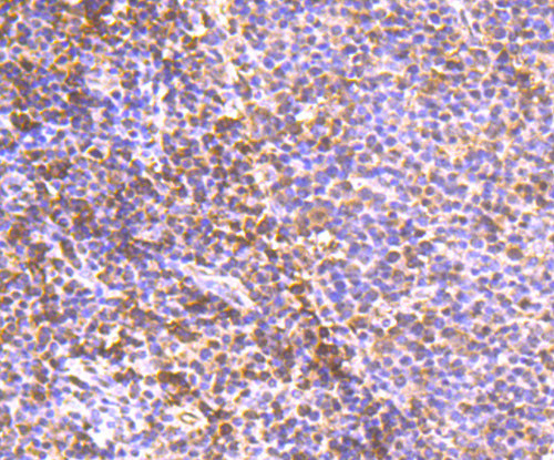 PDCD4 Antibody in Immunohistochemistry (Paraffin) (IHC (P))