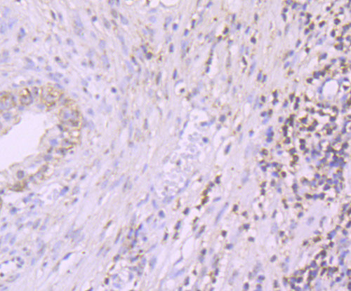 PDCD4 Antibody in Immunohistochemistry (Paraffin) (IHC (P))