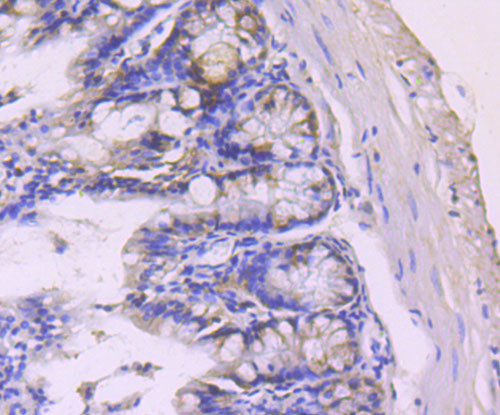 PDCD4 Antibody in Immunohistochemistry (Paraffin) (IHC (P))