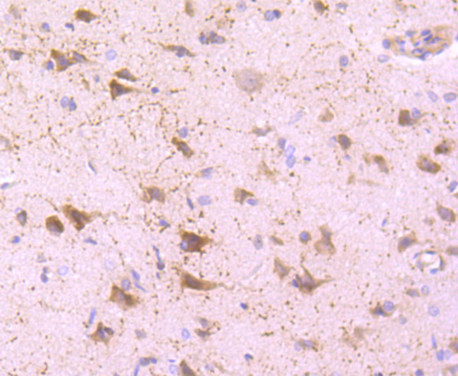 Calretinin Antibody in Immunohistochemistry (Paraffin) (IHC (P))