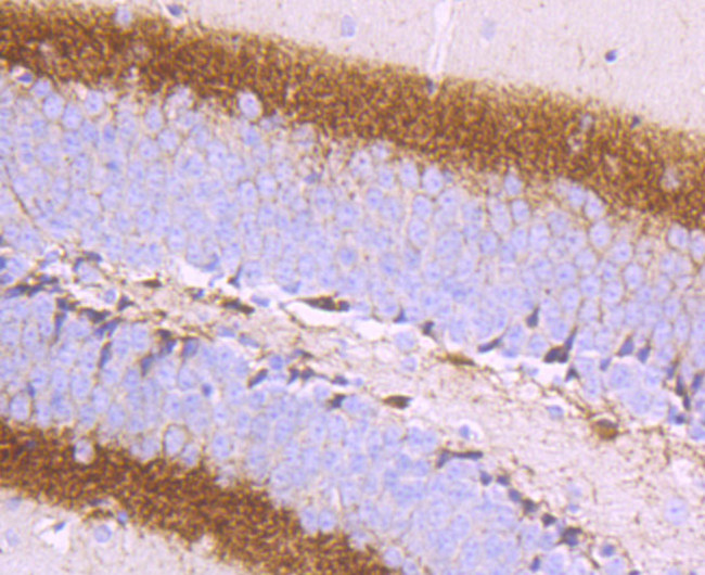 Calretinin Antibody in Immunohistochemistry (Paraffin) (IHC (P))