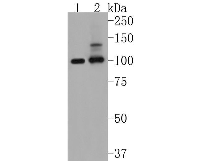 PSD93 Antibody in Western Blot (WB)