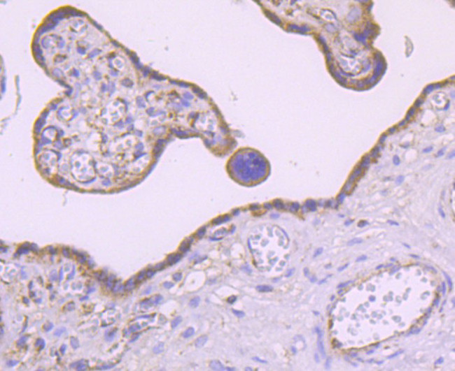 MMP3 Antibody in Immunohistochemistry (Paraffin) (IHC (P))