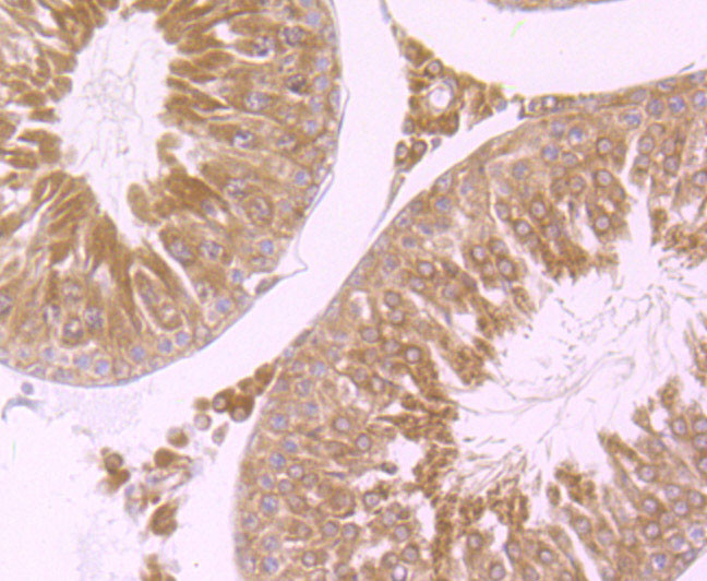 WNT2B Antibody in Immunohistochemistry (Paraffin) (IHC (P))