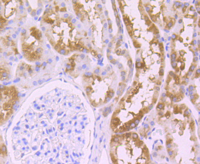 WNT2B Antibody in Immunohistochemistry (Paraffin) (IHC (P))