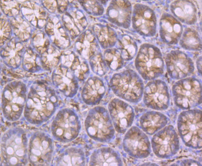 ApoA2 Antibody in Immunohistochemistry (Paraffin) (IHC (P))