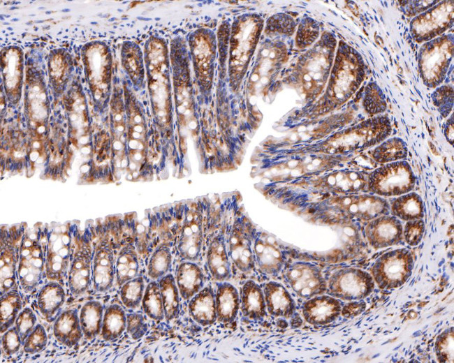 ApoA2 Antibody in Immunohistochemistry (Paraffin) (IHC (P))