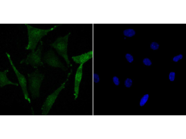 Phospho-CREB (Ser133) Antibody in Immunocytochemistry (ICC/IF)