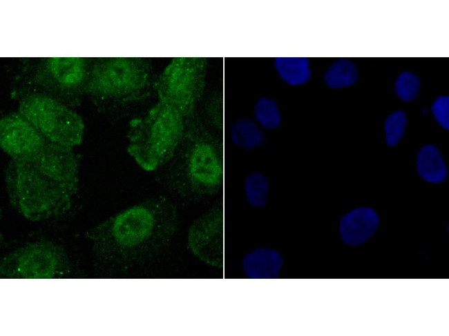 Phospho-CREB (Ser133) Antibody in Immunocytochemistry (ICC/IF)