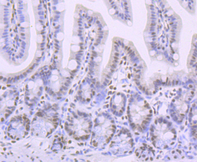 Phospho-CREB (Ser133) Antibody in Immunohistochemistry (Paraffin) (IHC (P))