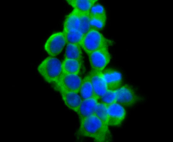 VAMP1 Antibody in Immunocytochemistry (ICC/IF)