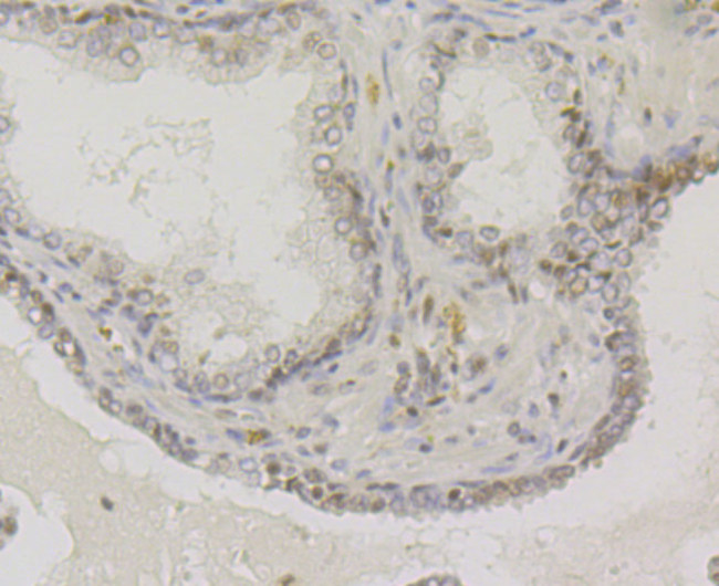 VAMP1 Antibody in Immunohistochemistry (Paraffin) (IHC (P))