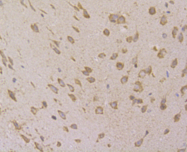 VAMP1 Antibody in Immunohistochemistry (Paraffin) (IHC (P))