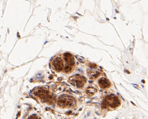 ICAD Antibody in Immunohistochemistry (Paraffin) (IHC (P))